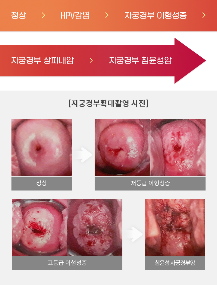 진행과정